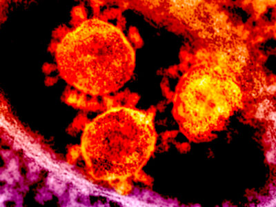 Coronavirus COVID-19 todos los DATOS que debes conocer