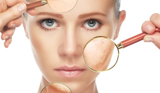 ¿Tu piel está empezando a envejecer? Aconsejamos cómo combatir las arrugas